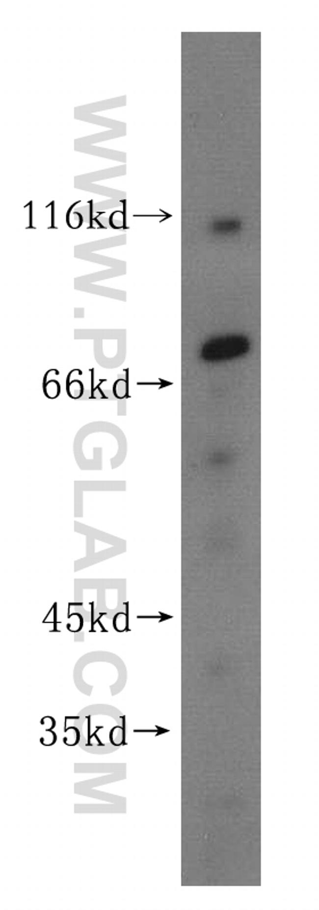 Cytokeratin 1 Antibody in Western Blot (WB)