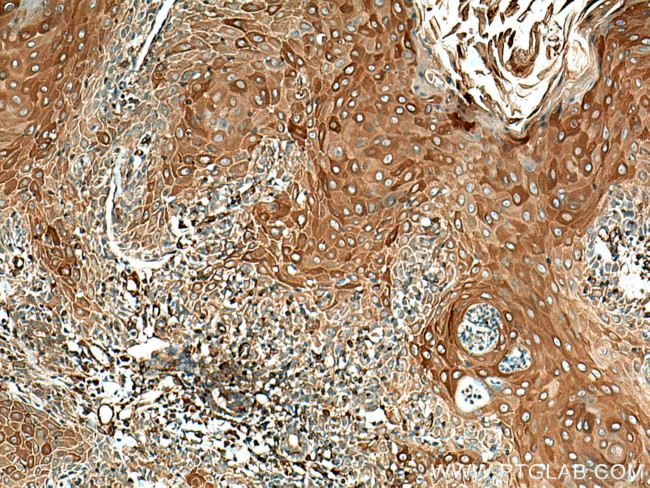 Cytokeratin 10 Antibody in Immunohistochemistry (Paraffin) (IHC (P))