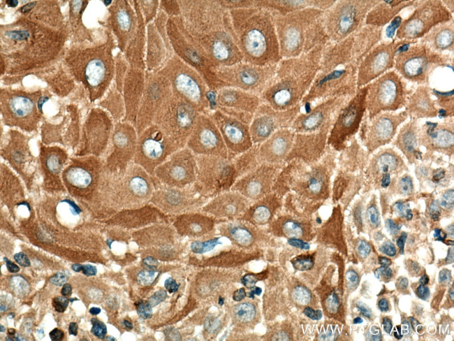 Cytokeratin 10 Antibody in Immunohistochemistry (Paraffin) (IHC (P))