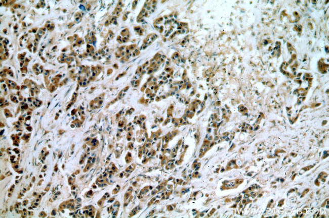 Cytokeratin 10 Antibody in Immunohistochemistry (Paraffin) (IHC (P))