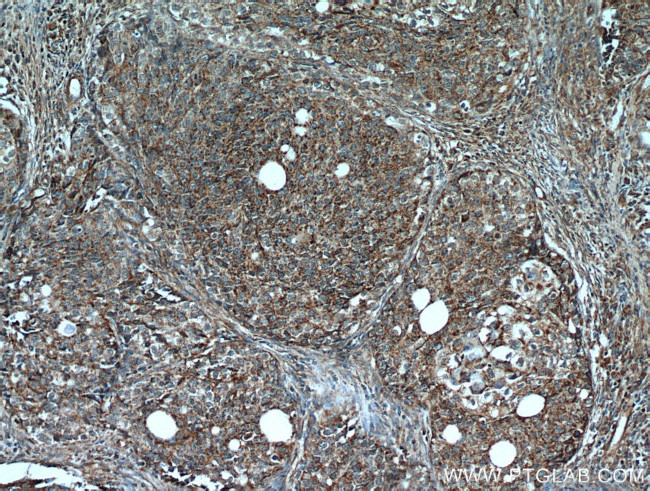 Cytokeratin 10 Antibody in Immunohistochemistry (Paraffin) (IHC (P))