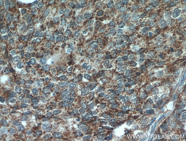 Cytokeratin 10 Antibody in Immunohistochemistry (Paraffin) (IHC (P))