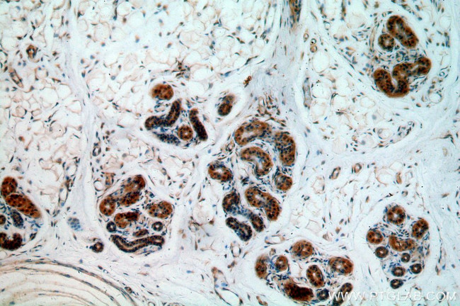 Cytokeratin 10 Antibody in Immunohistochemistry (Paraffin) (IHC (P))