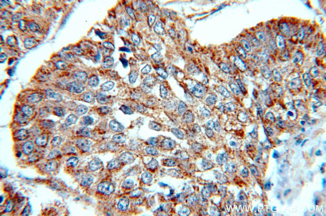 Cytokeratin 10 Antibody in Immunohistochemistry (Paraffin) (IHC (P))