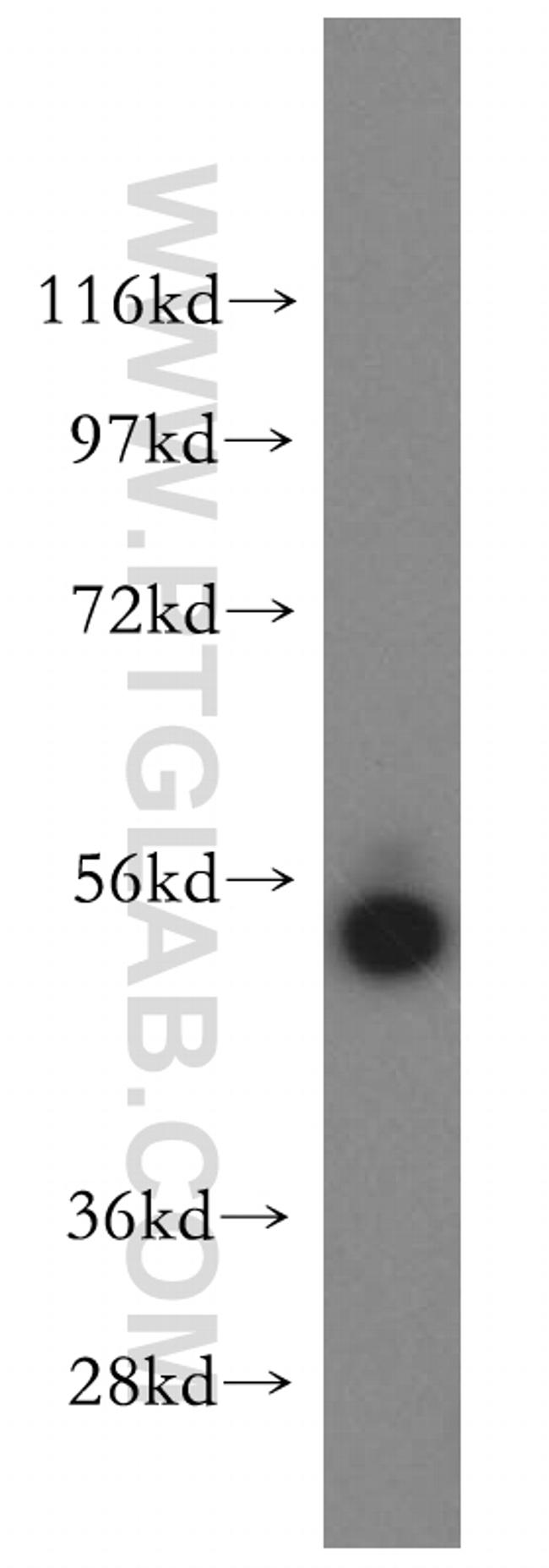 FMO2 Antibody in Western Blot (WB)