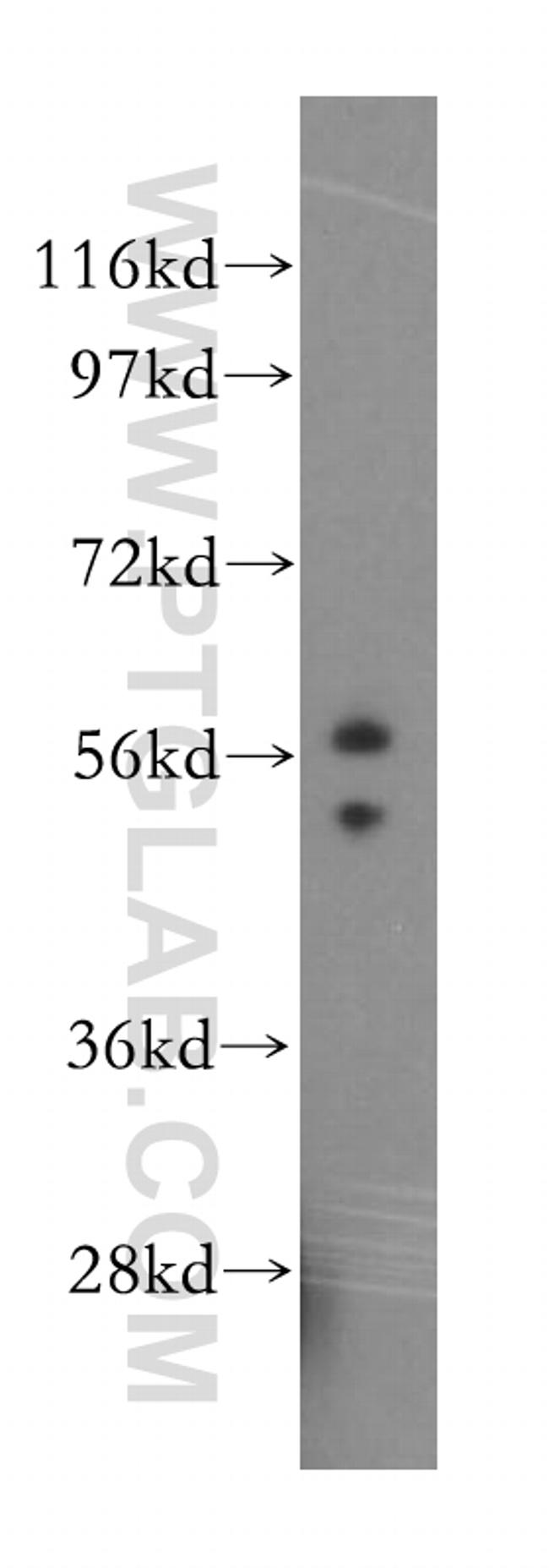 FMO2 Antibody in Western Blot (WB)