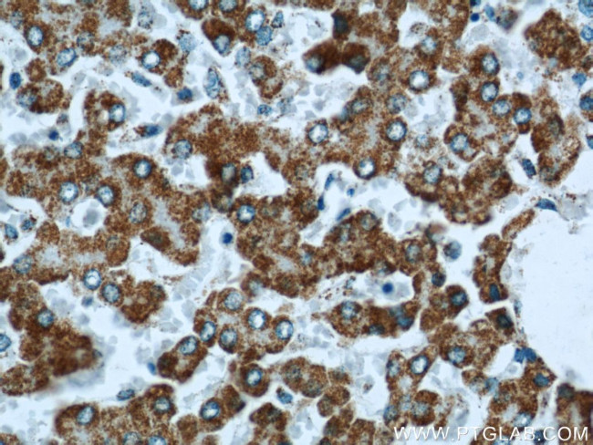 FMO5 Antibody in Immunohistochemistry (Paraffin) (IHC (P))