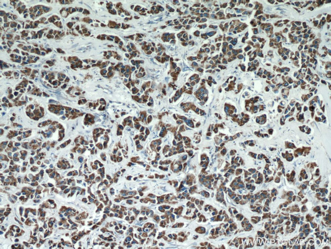 FMO5 Antibody in Immunohistochemistry (Paraffin) (IHC (P))