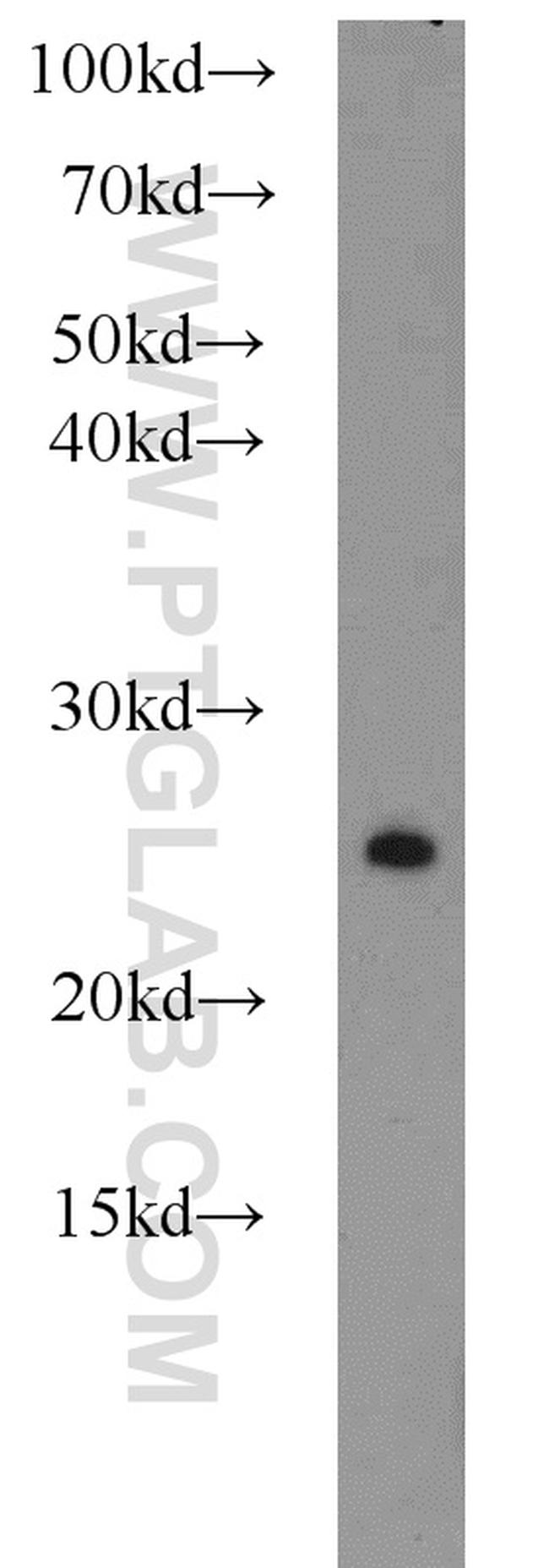 RAB3A Antibody in Western Blot (WB)