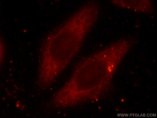 RAB3A Antibody in Immunocytochemistry (ICC/IF)