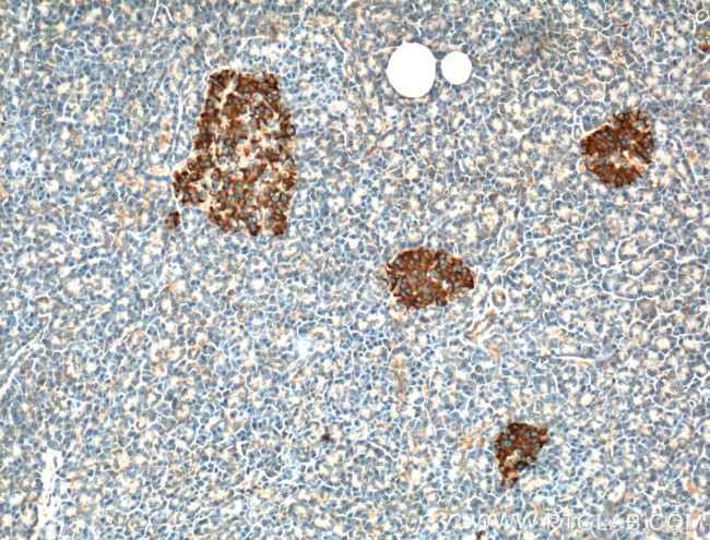 RAB3A Antibody in Immunohistochemistry (Paraffin) (IHC (P))