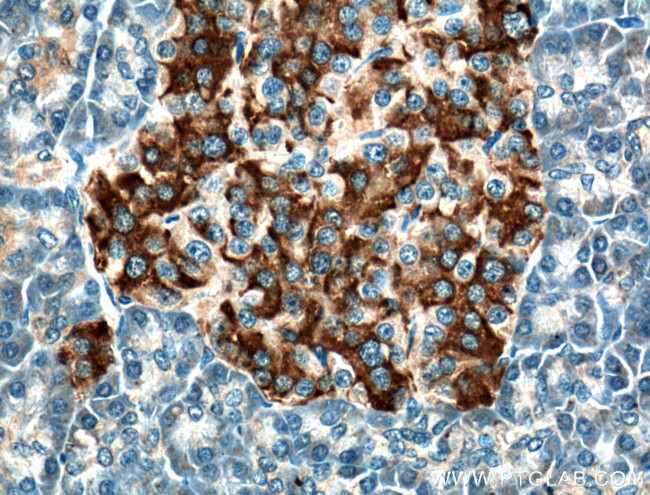 RAB3A Antibody in Immunohistochemistry (Paraffin) (IHC (P))