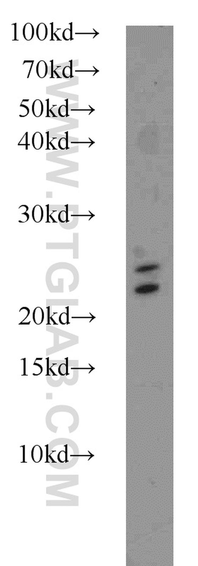 RAB3A Antibody in Western Blot (WB)