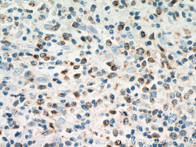 RAB27A Antibody in Immunohistochemistry (Paraffin) (IHC (P))