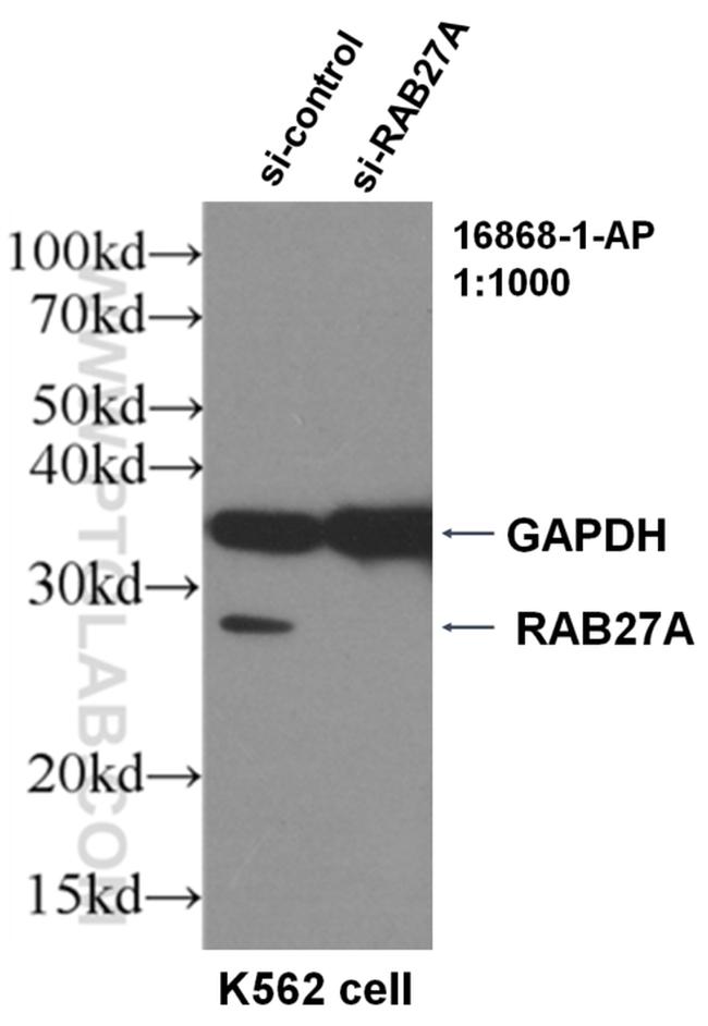 RAB27A Antibody in Western Blot (WB)