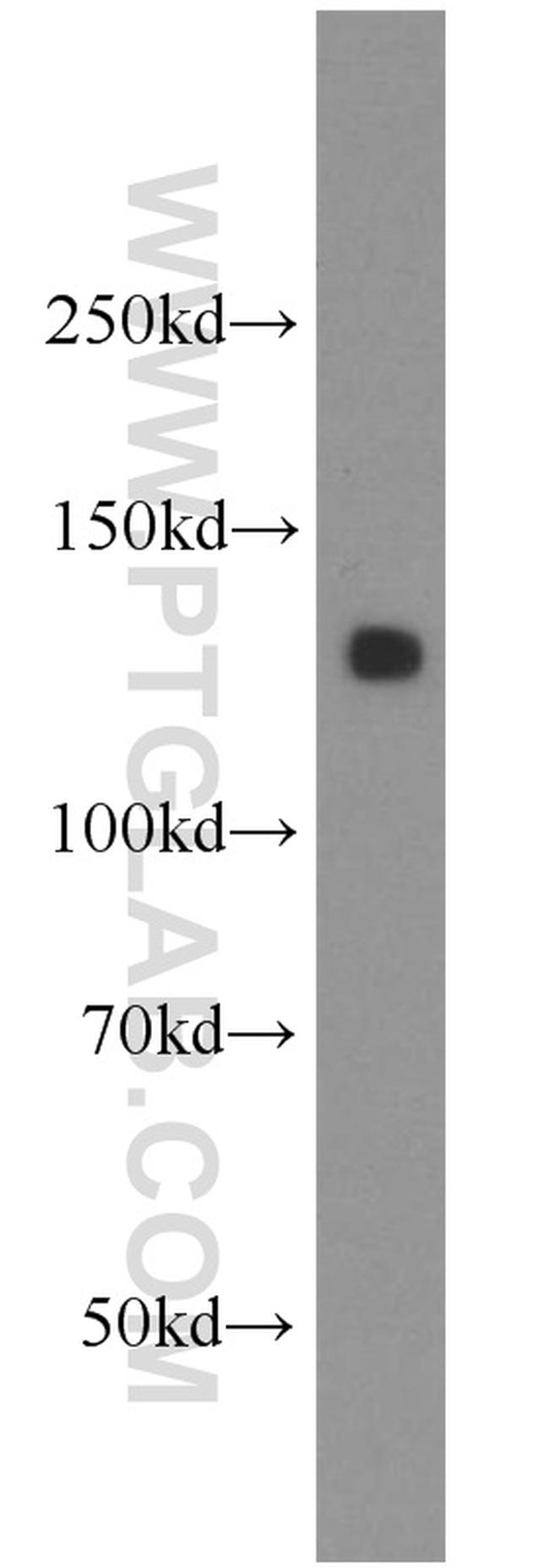 AMOT Antibody in Western Blot (WB)