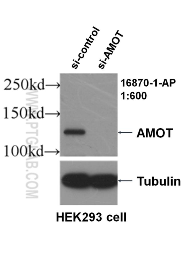 AMOT Antibody in Western Blot (WB)