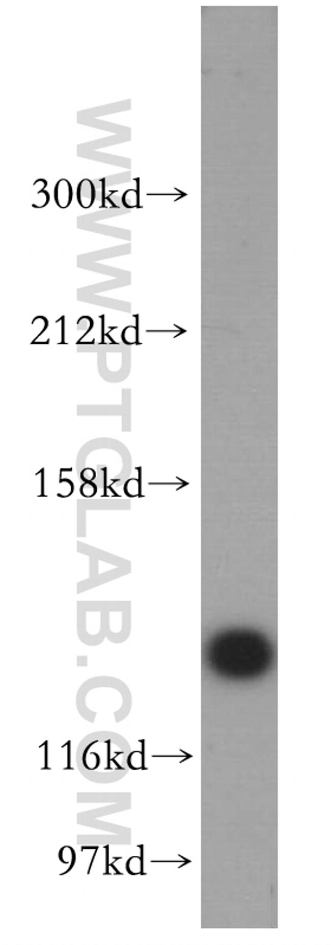 AMOT Antibody in Western Blot (WB)