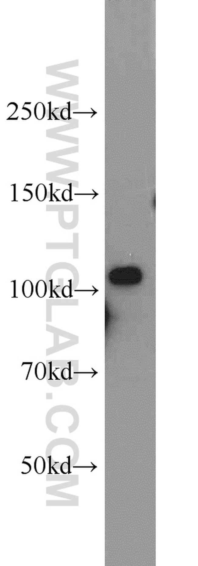 AMOTL1 Antibody in Western Blot (WB)