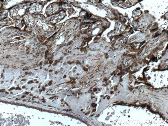 FGF3 Antibody in Immunohistochemistry (Paraffin) (IHC (P))