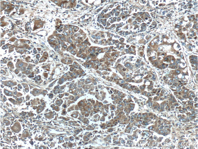 FGF3 Antibody in Immunohistochemistry (Paraffin) (IHC (P))