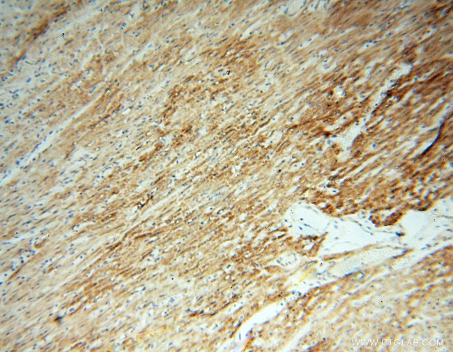 FGF16 Antibody in Immunohistochemistry (Paraffin) (IHC (P))