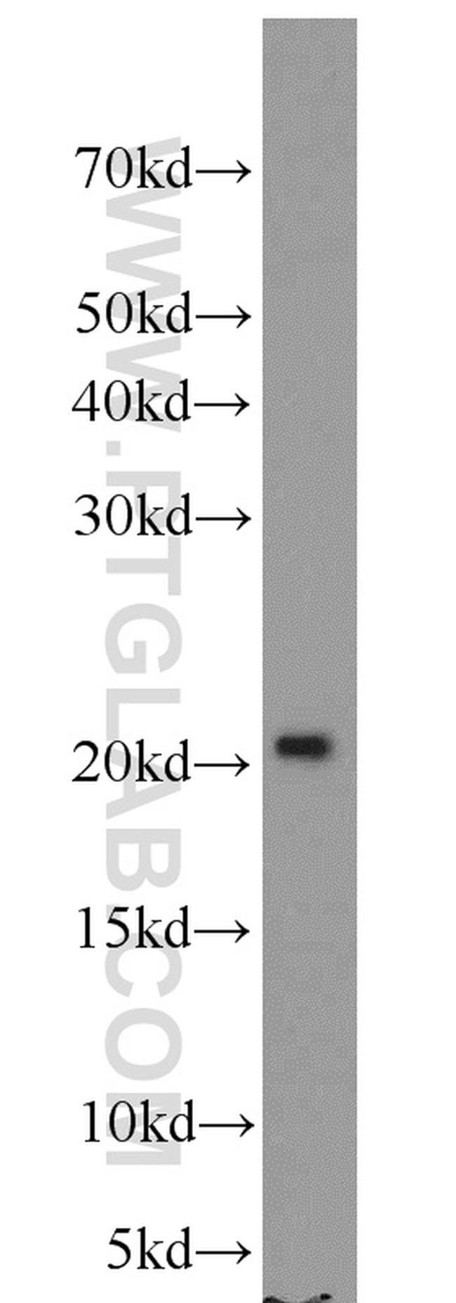 FGF16 Antibody in Western Blot (WB)