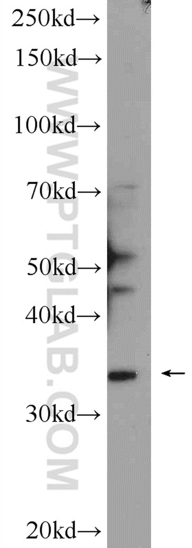 ATAD1 Antibody in Western Blot (WB)