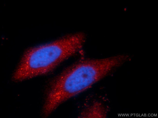 SPAG16 Antibody in Immunocytochemistry (ICC/IF)