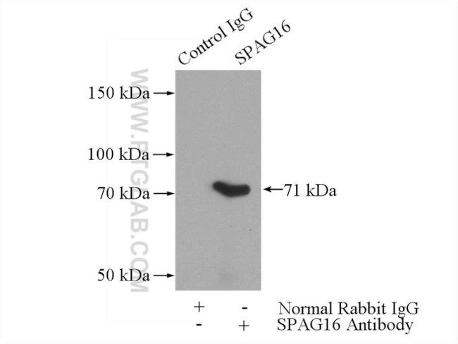 SPAG16 Antibody in Immunoprecipitation (IP)