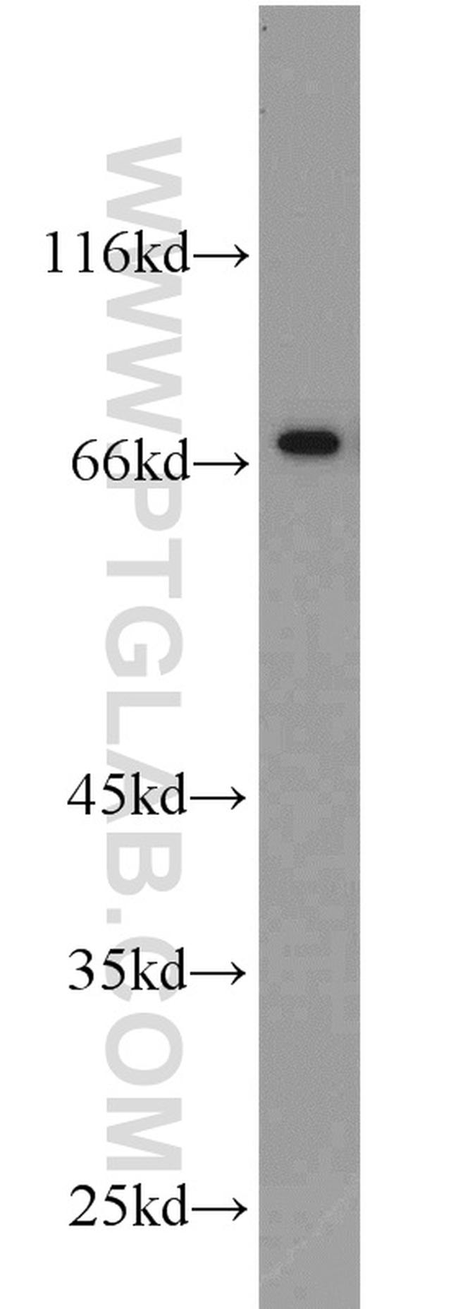 SPAG16 Antibody in Western Blot (WB)