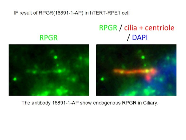 RPGR Antibody in Immunocytochemistry (ICC/IF)