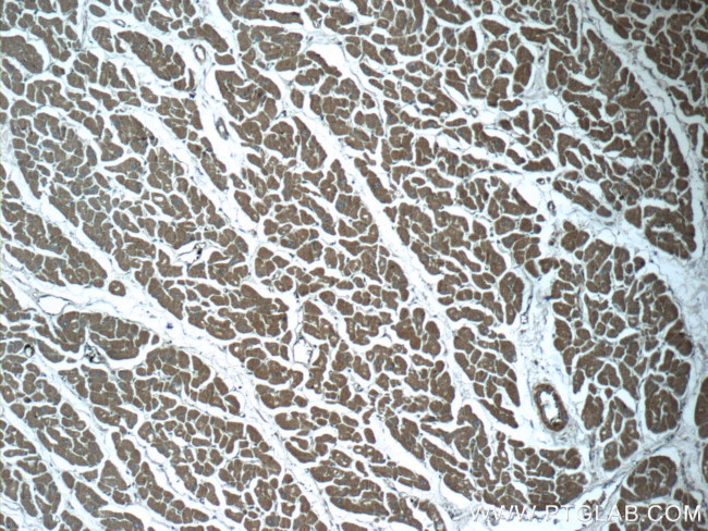 RPGR Antibody in Immunohistochemistry (Paraffin) (IHC (P))