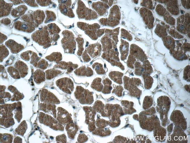 RPGR Antibody in Immunohistochemistry (Paraffin) (IHC (P))