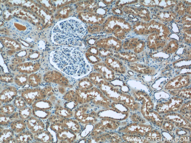 RPGR Antibody in Immunohistochemistry (Paraffin) (IHC (P))