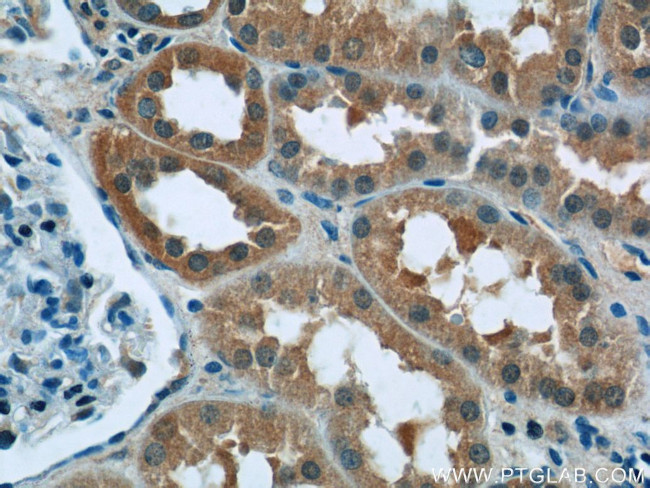 RPGR Antibody in Immunohistochemistry (Paraffin) (IHC (P))