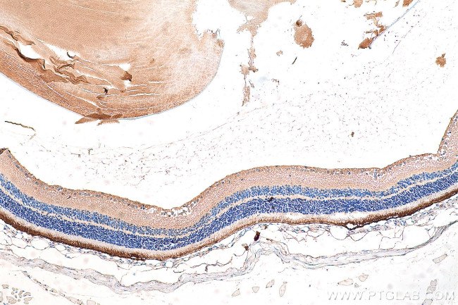 RPGR Antibody in Immunohistochemistry (Paraffin) (IHC (P))