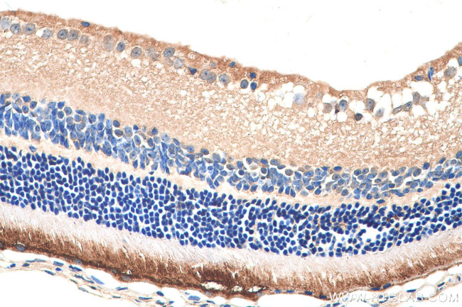 RPGR Antibody in Immunohistochemistry (Paraffin) (IHC (P))