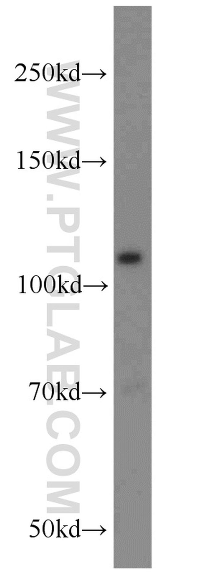 RPGR Antibody in Western Blot (WB)