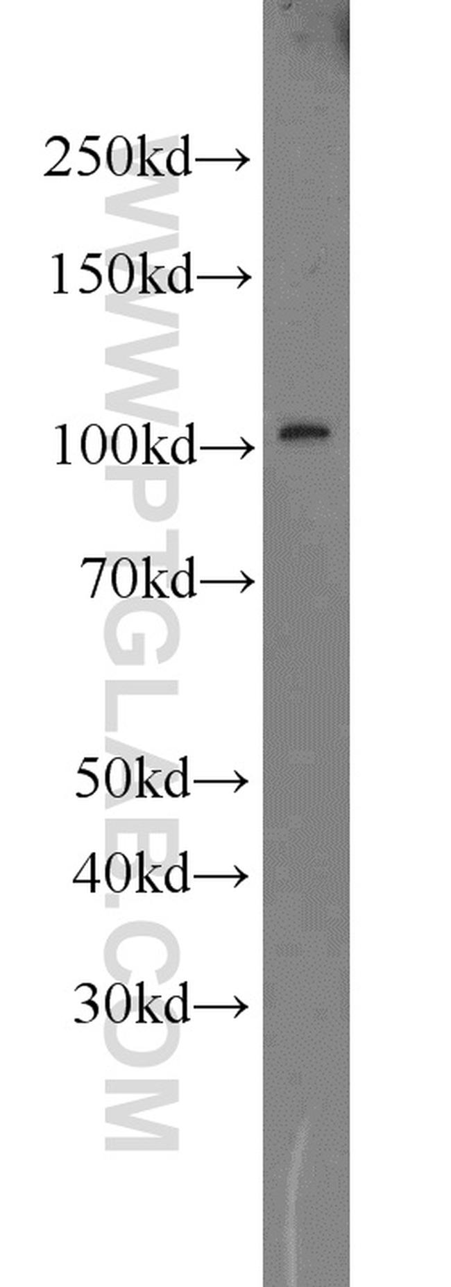 RPGR Antibody in Western Blot (WB)