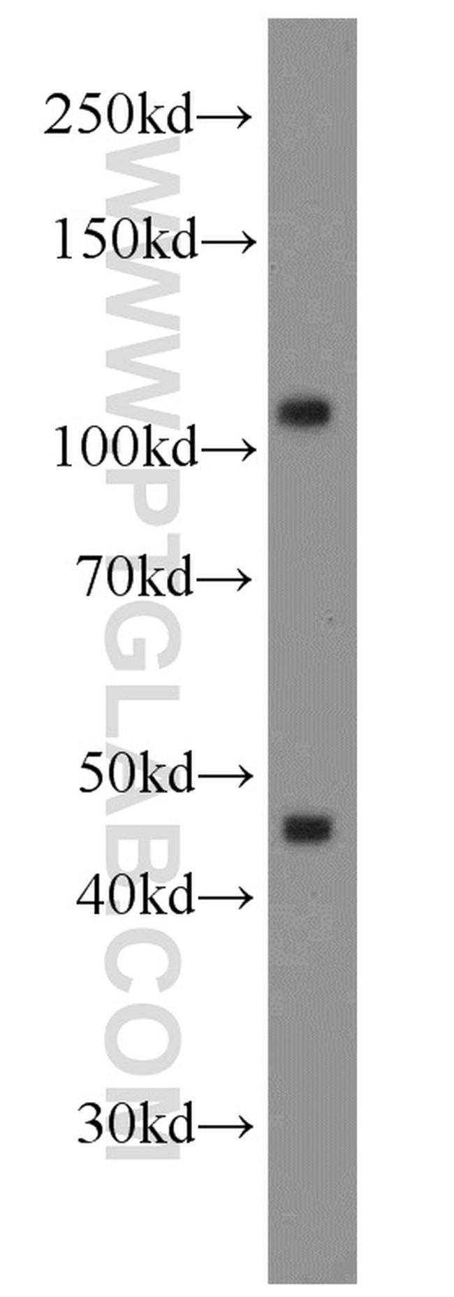 RPGR Antibody in Western Blot (WB)