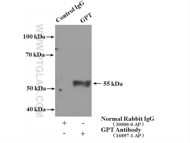 GPT Antibody in Immunoprecipitation (IP)