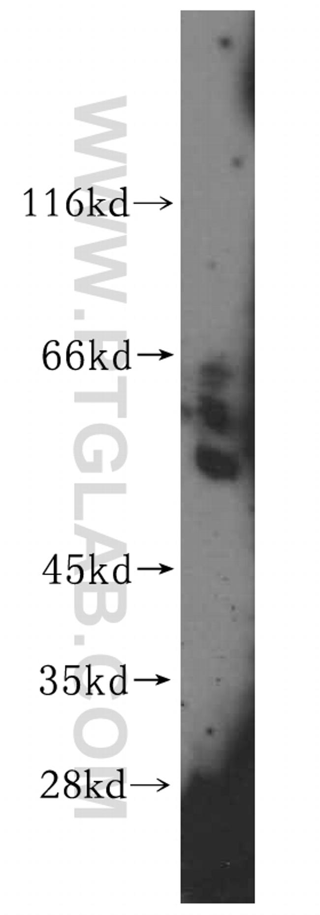 GPT Antibody in Western Blot (WB)