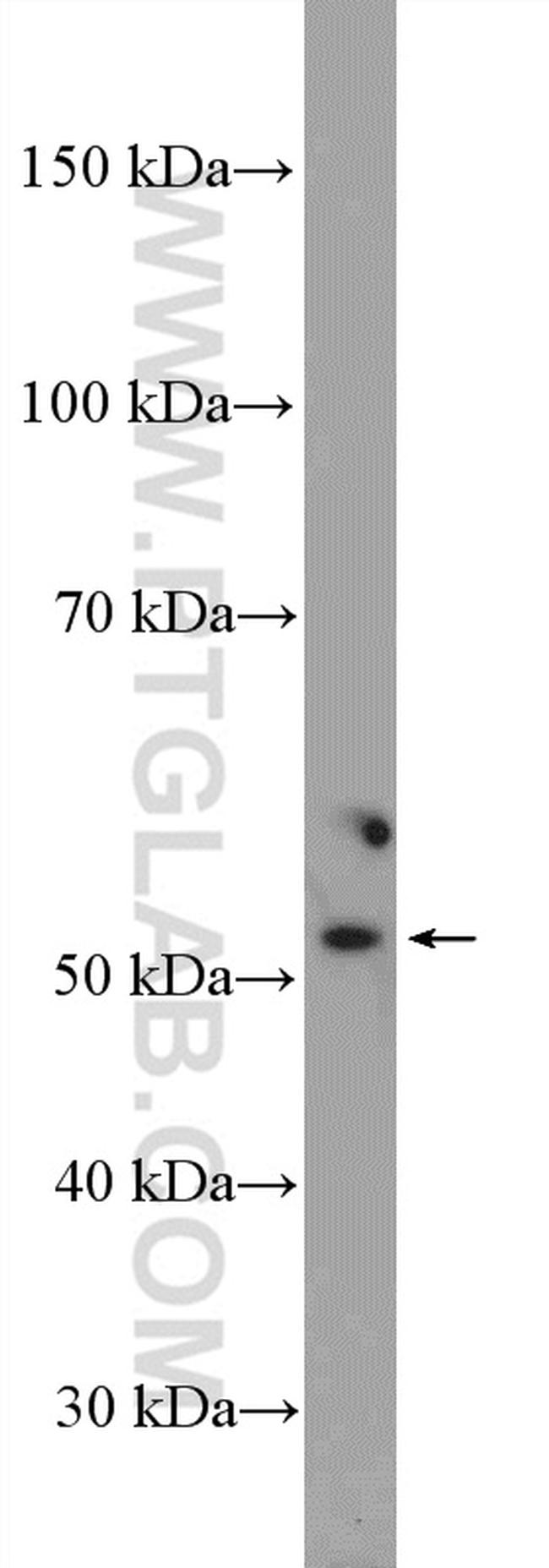 GPT Antibody in Western Blot (WB)