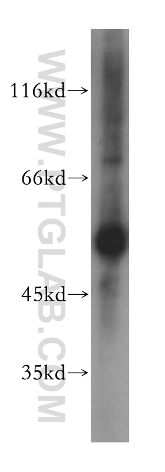 GPT Antibody in Western Blot (WB)