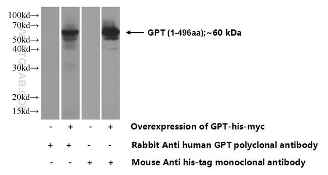 GPT Antibody in Western Blot (WB)