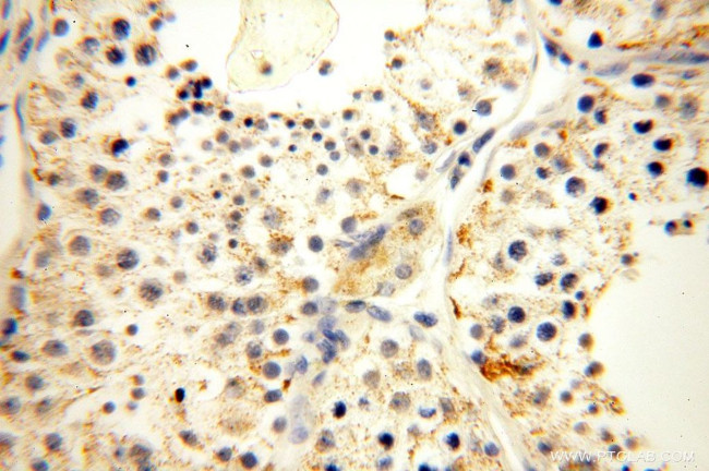 HMGCL Antibody in Immunohistochemistry (Paraffin) (IHC (P))