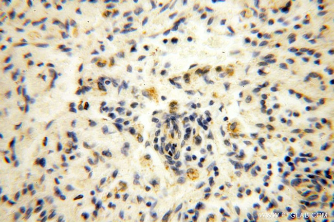 HMGCL Antibody in Immunohistochemistry (Paraffin) (IHC (P))