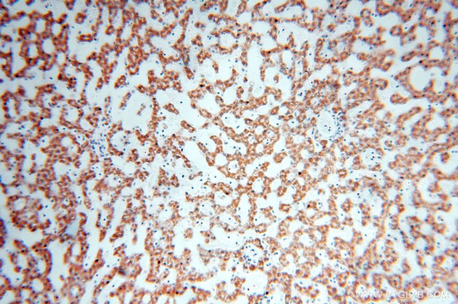 HMGCL Antibody in Immunohistochemistry (Paraffin) (IHC (P))