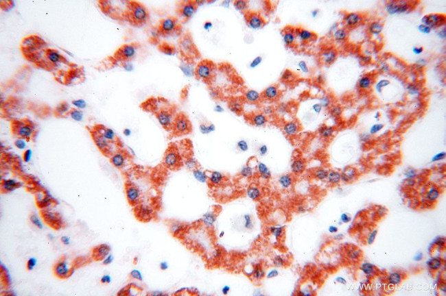 HMGCL Antibody in Immunohistochemistry (Paraffin) (IHC (P))